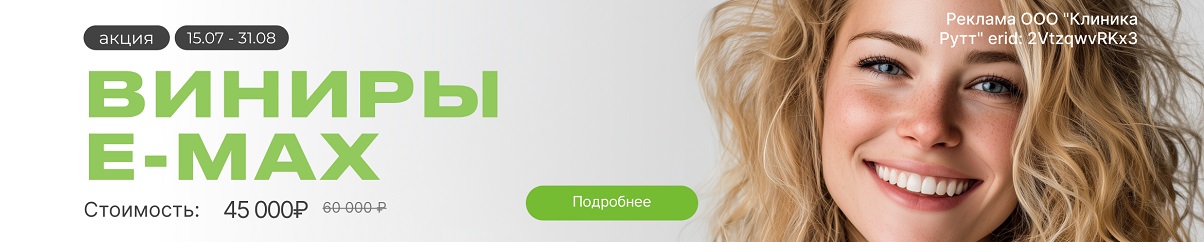 Виниры E-max