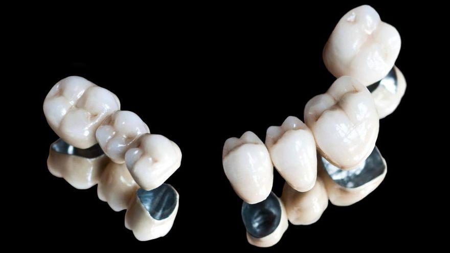 Зубные коронки из металлопластмассы
