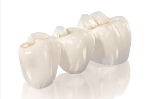 Циркониевые зубные протезы