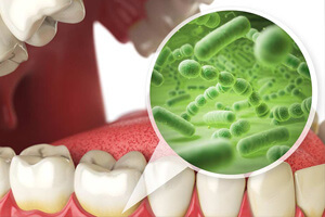 Множество микроорганизмов в полости рта