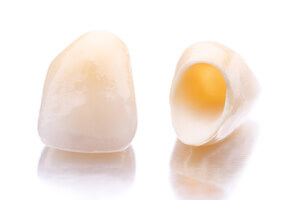 Керамические зубные протезы